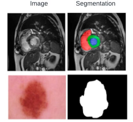 Medical Image Segmentation Example