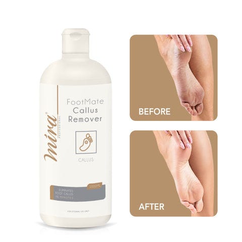 Mira Callus Remover - al basel cosmetics