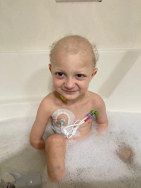 A little boy with a bald head and multiple ports happily sitting in a bathtub filled with bubbles.