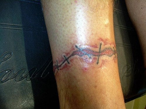 1081 Ankle Tattoo