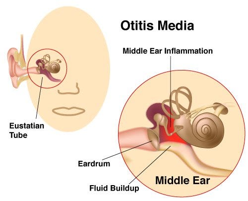 Hearing Loss After Ear Infection Adult: Causes and Treatments