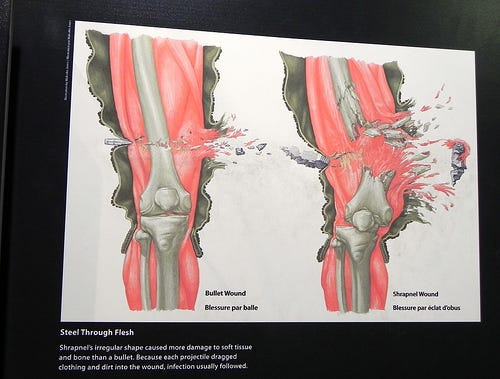 Bullet wound vs shrapnel wound