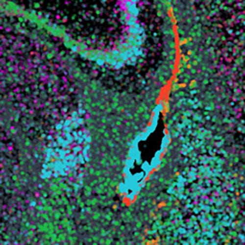 Advanced Tissue Analysis via Spatial Transcriptomics at Nexco