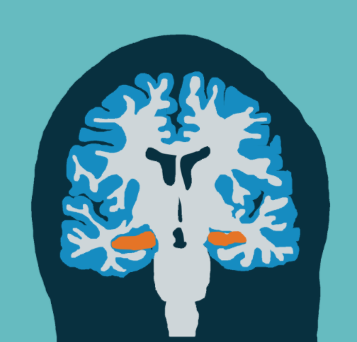 Quantifying hippocampal volume: manually or AI powered?