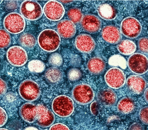 Monkeypox virus under magnification