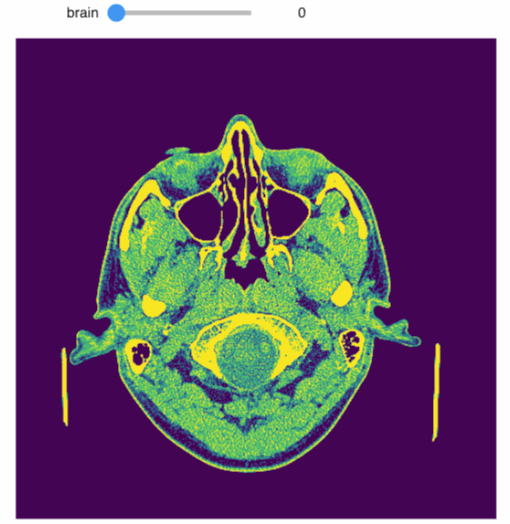 A GIF of a sequential walkthrough of the axial view of a cranial CT scan, as rendered through an ipywidget in the default colormap of matplotlib.