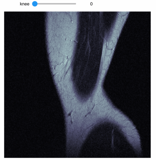 A GIF of a knee CT scan in the sagittal plane that shows a sequential walkthrough of DICOM images using an interactive Python widget.