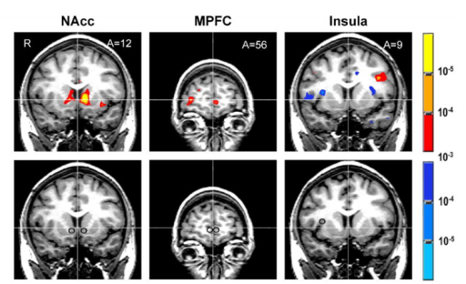 Actividad-cerebral-insula