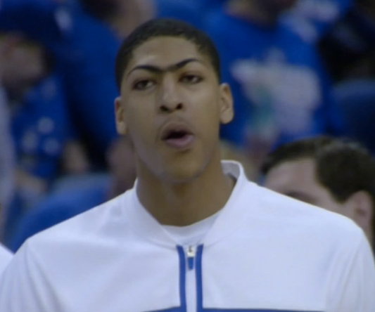 Anthony Davis Unibrow