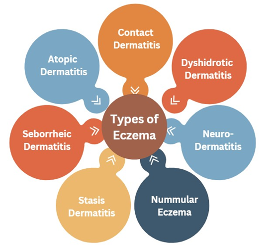 Types of Eczema