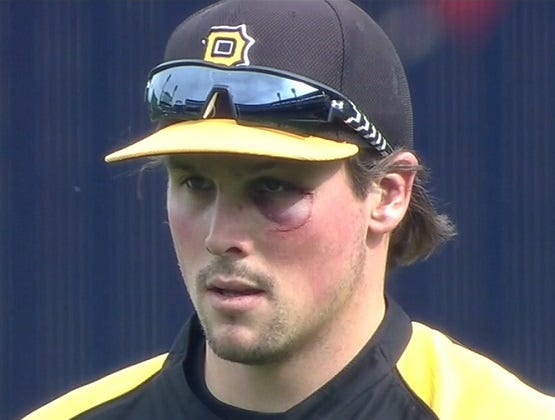 travis-snider-black-eye-pirates