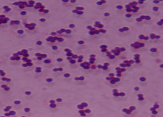 Gram positive S. aureus.