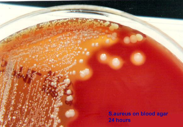 Colony morphology in blood agar