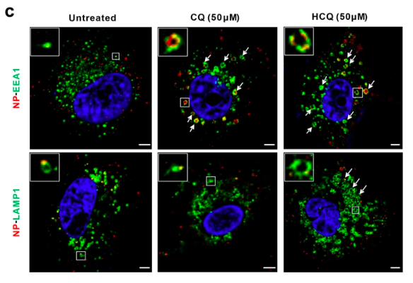 in vitro effects of hydrochloroquine on coronavirus (Covid-19)