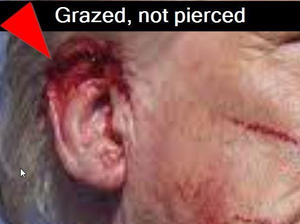 Trump’s bloody ear where the bullet nicked his ear