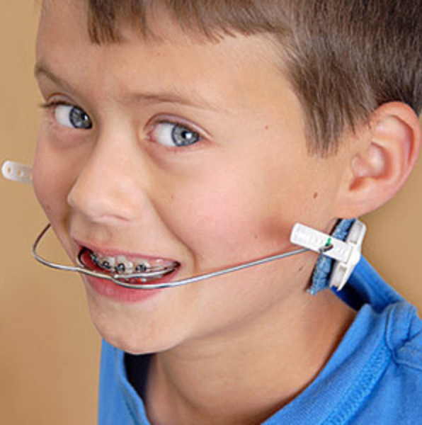 kid with orthodontic headgear