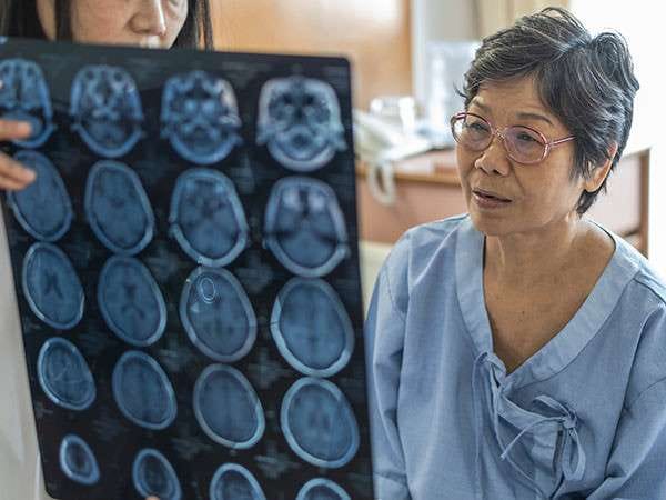 Novo Medicamento contra Alzheimer Aprovado e agora? Aducanumab