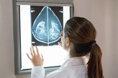 A doctor examines a mammogram.