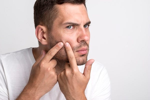 4 Amazing Skincare Tips for Guys with Oily Acne-Prone Skin