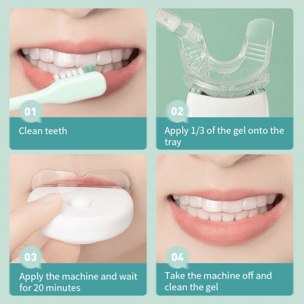 How to use a teeth whitening kit