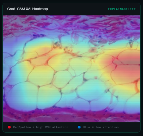 From VGG16 to EfficientNetB1: What I Learned Building a Medical AI Tool as a Student