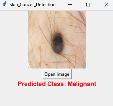 Skin Tumor Classification using Convolutional Neural Networks
