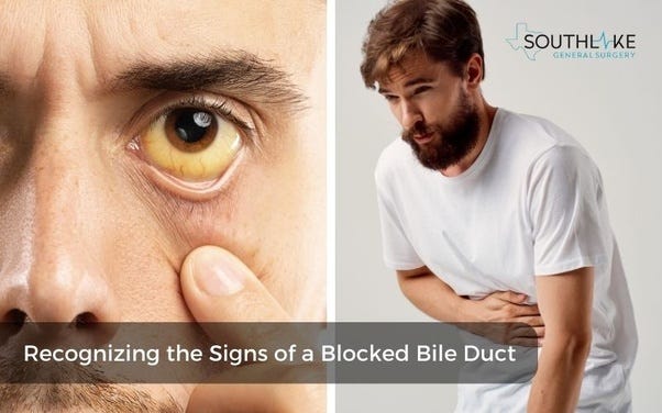 Symptoms of the blocked bile duct: jaundice, abdominal pain, dark urine