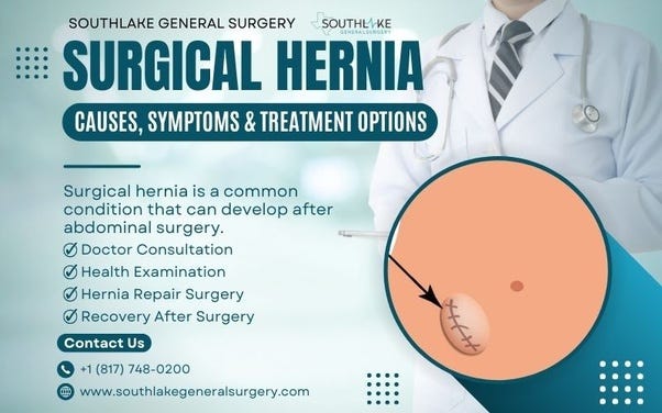 Illustration of a surgical hernia showing a protrusion near an abdominal surgical incision.
