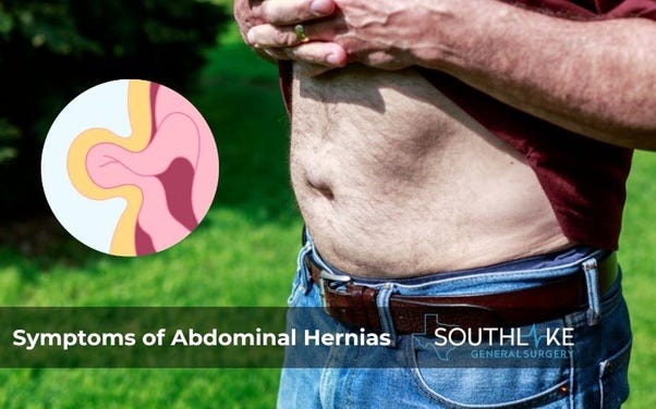 Visible bulge and discomfort: Symptoms of abdominal hernias