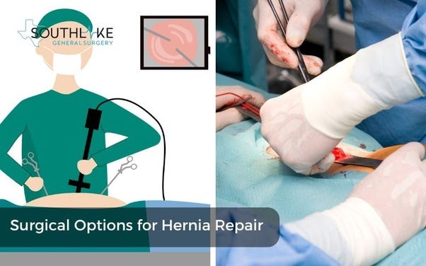 Comparison of open surgery and laparoscopic surgery for hernia repair.