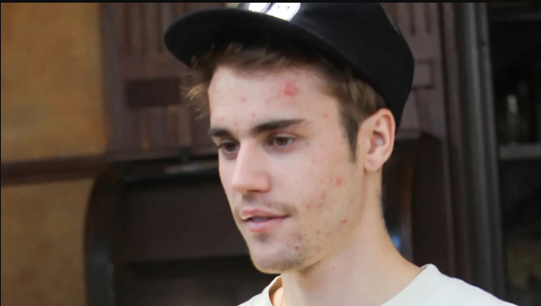 Justin Bieber Reveals He Has Lyme Disease