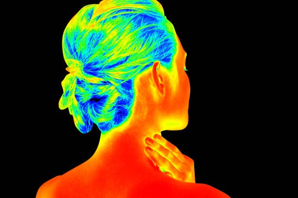 Infrared camera picture of a lady