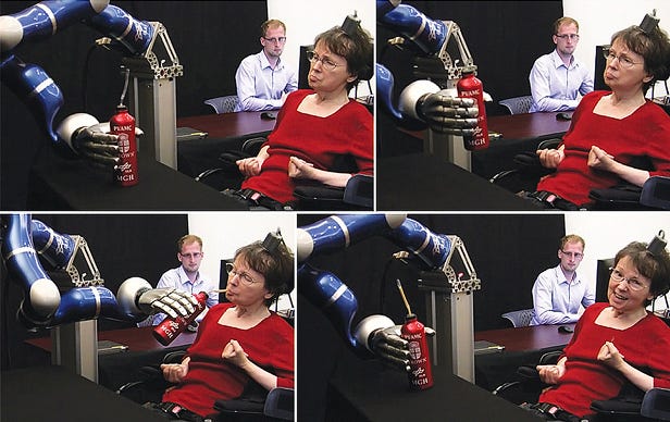 Person using a brain-computer interface and neuromorphic technology to control a robotic arm, showcasing the potential for advanced prosthetics.