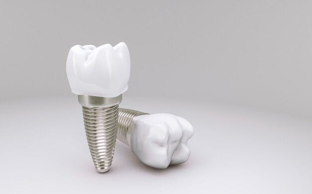 This image is about Things That Disqualifies You From Dental Implants