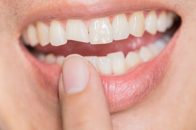 Iqaluit Dental Clinic image of a person with nice white teeth.