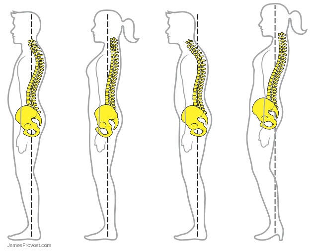 Pelvic tilts and different kinds of tension patterns related