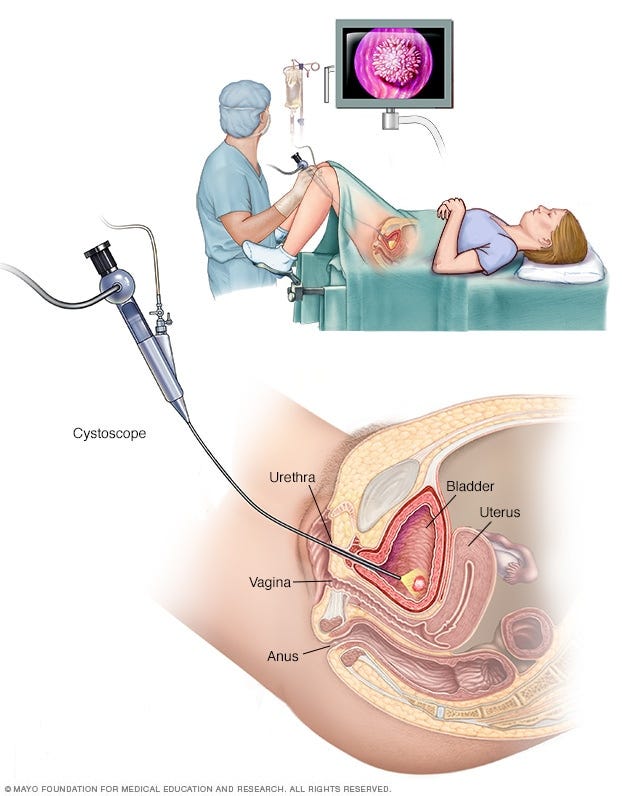 Urinary System