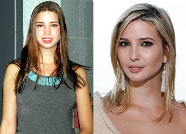 Image result for ivanka before surgery
