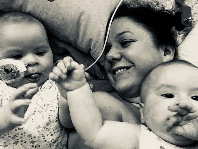 Ella and Eve, 15-Month-Old Twins’ Journey Battling a Rare Eye Cancer image