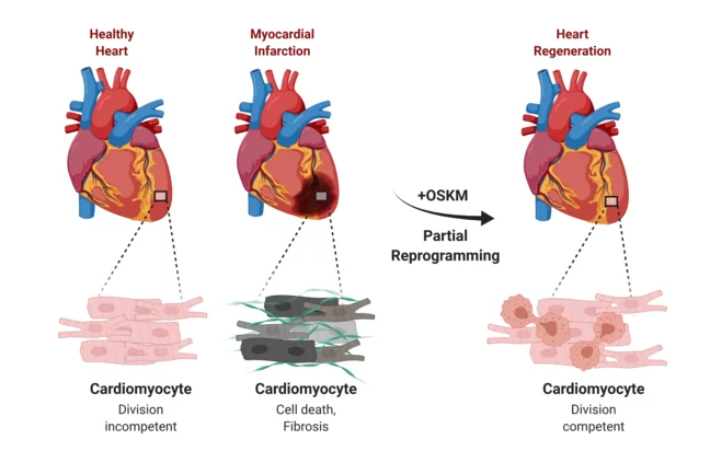 Treatment with Yamanaka Factors regenerates and repairs the heart after myocardial infarction.