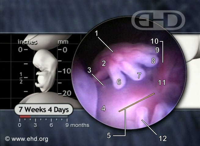 embryo at 7 weeks. How the abortion pill works