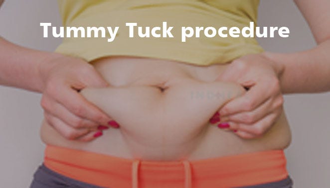 Tummy tuck surgery in India