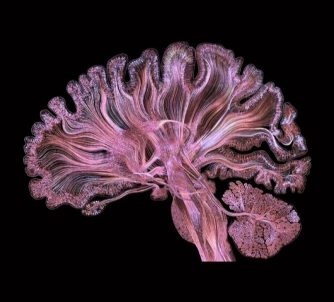 A brain image in pink