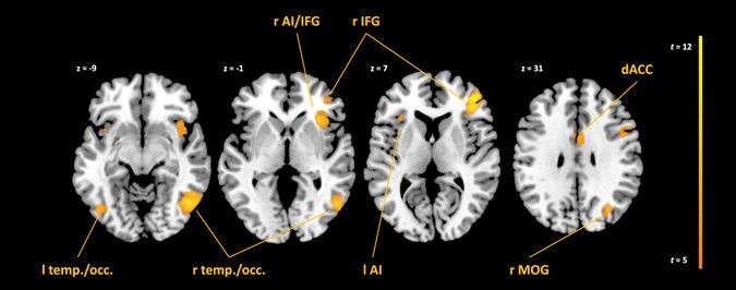 Quelle: Scientific Reports 7, Article number: 5804 (2017) doi:10.1038/s41598-017-03935-y