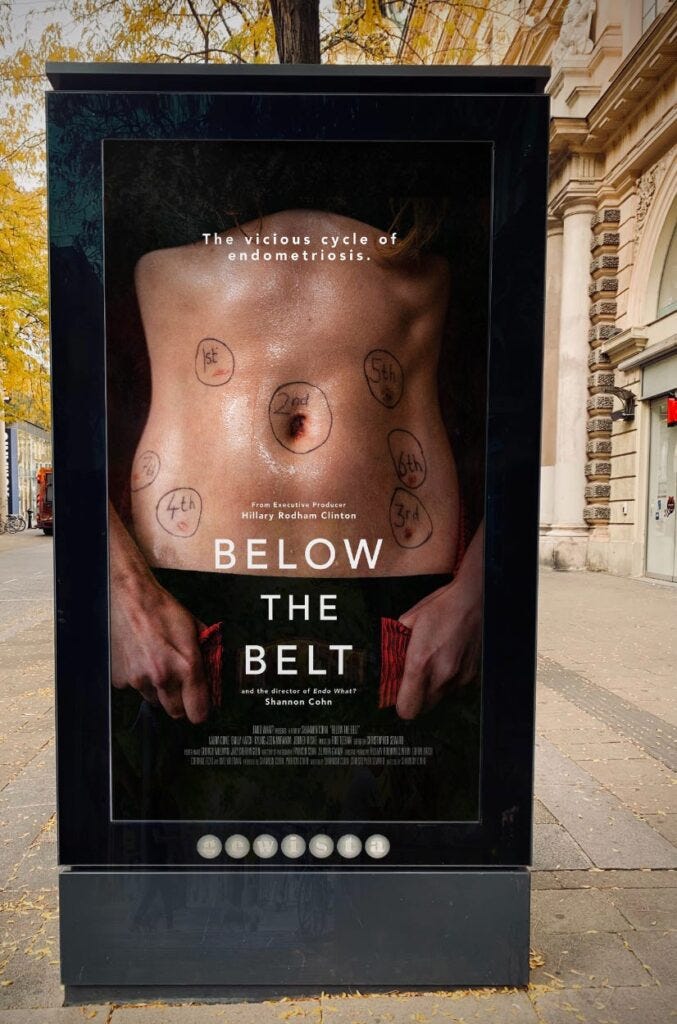 Photo of a movie poster for Below the Belt, showing a woman’s bare abdomen. Every surgical scar is circled and dated.