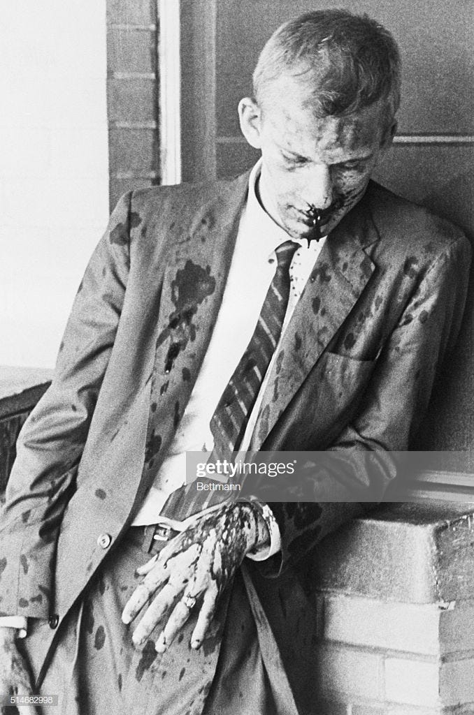 Freedom Rider, James Zwerg, stands bleeding, after an attack by white pro-segregationists in Montgomery, Alabama.