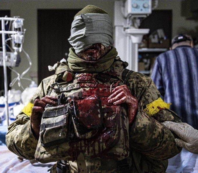 Serious injuries to the body of a Ukrainian soldier.