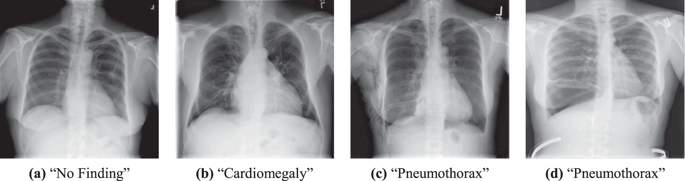 Examples of X-ray images with their respective label, i.e. diagnosis, Baltruschat et al. 2019.