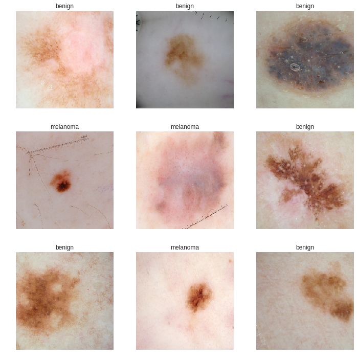 Cancer benign skin, Skin cancer benign vs malignant