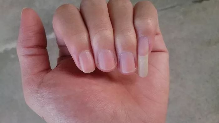 In addition to growing out the pinky nail, some people also grow their thumbnail long (image sourced from the internet).